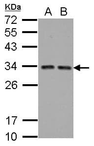 IHC-plus™ TIP30 / HTATIP2 Antibody