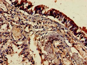 EDNRB / Endothelin B Receptor Antibody