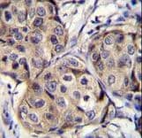 CBLN2 / Cerebellin 2 Antibody (aa179-207)