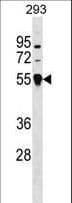TRIM26 Antibody (aa141-169)