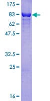 Human RAD23B / HR23B Protein (Recombinant GST)