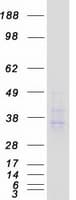 Human ACKR2 / CCR10 / D6 Protein (Recombinant Myc-DDK (Flag))