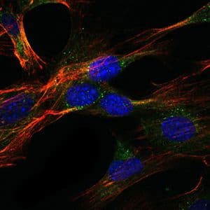 Monoclonal Mouse anti-Human GKAP1 Antibody (clone 3G4, IHC, IF, WB)