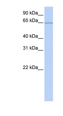 Polyclonal Rabbit anti-Human KIAA0020 / PEN Antibody (aa451-500, WB)