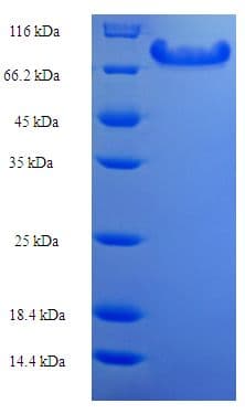 Human ANGPTL2 / ARP2 Protein (Recombinant His-SUMO)