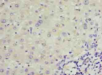 TRPM2 Antibody (aa60-119)