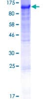 Human DVL2 / Dishevelled 2 Protein (Recombinant GST)