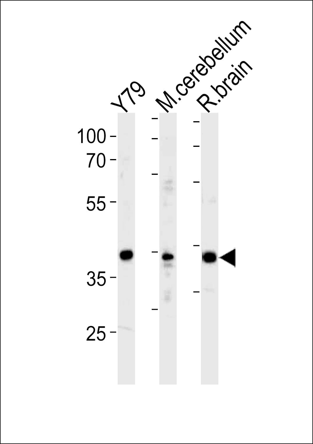 NEUROD1 Antibody (aa318-348)