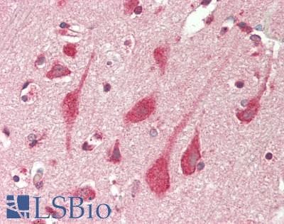 IHC-plus™ Polyclonal Rabbit anti-Human LNPEP Antibody (aa1-50, IHC, WB)