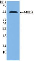 Aspartate Aminotransferase Antibody (aa1-413)