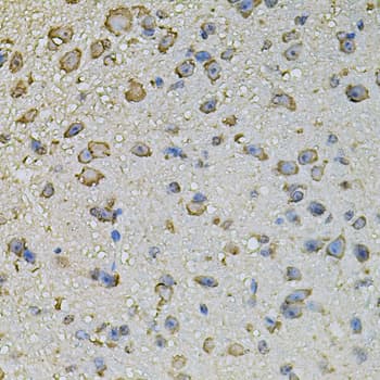 CREBBP / CREB Binding Protein Antibody