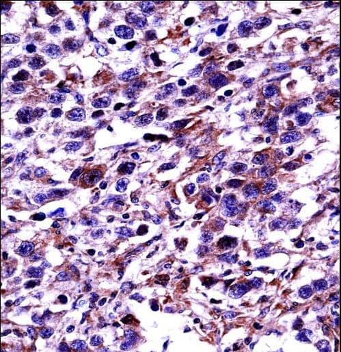 Polyclonal Rabbit anti-Human POU2F2 / OCT2 Antibody (aa10-39, IHC, WB)