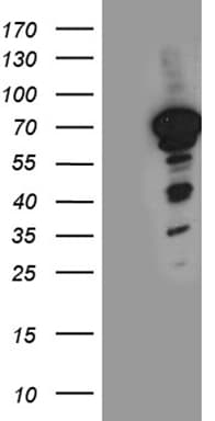 NFIA / Nuclear Factor 1 Antibody (aa200-509, clone OTI6F1)