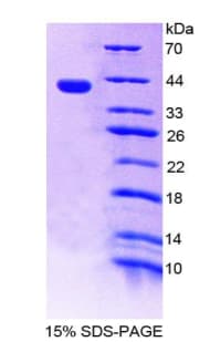 Human ADAP1 / CENTA1 Protein (Recombinant His-T7)