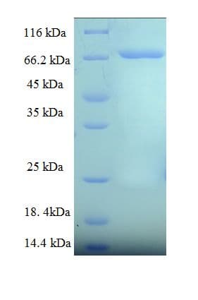 Human CPEB1 / CPEB Protein (Recombinant His-SUMO)
