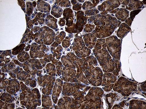 Monoclonal Mouse anti-Human AIFM1 / AIF / PDCD8 Antibody (clone OTI4E6, aa134-483, IHC, WB)