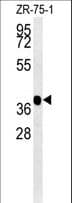 NPAL2 / NIPAL2 Antibody (aa57-86)