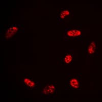 HDAC3 Antibody (C-Terminus)