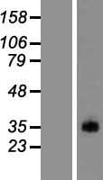 PRSS38 Protein (Over-Expression Lysate Myc-DDK (Flag))