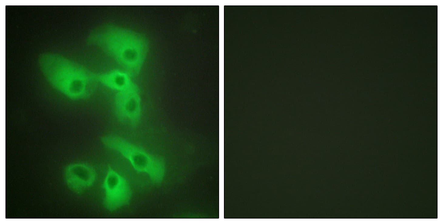 MAPK8IP2 / JIP2 Antibody (aa581-630)