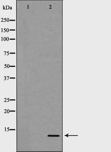 Polyclonal Rabbit anti-Human S100A4 / FSP1 Antibody (WB)
