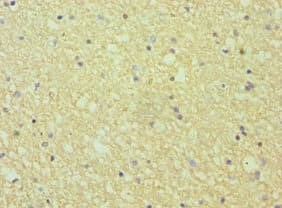 Polyclonal Rabbit anti-Human EFNA1 / Ephrin A1 Antibody (aa19-182, IHC)