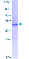 Human GALP / Alarin Protein (Recombinant GST)