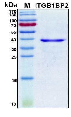 Human ITGB1BP2 / MELUSIN Protein (Recombinant 6His, N-terminus)