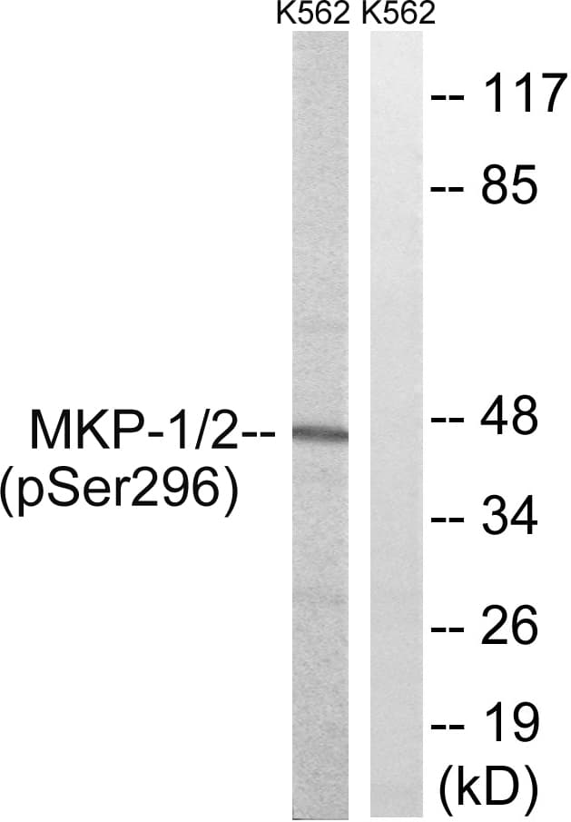 DUSP1 / MKP1 Antibody (phospho-Ser296/Ser318)