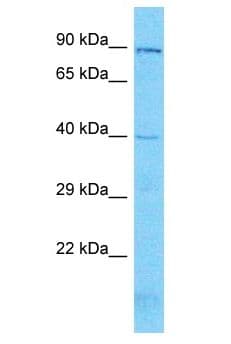 Polyclonal Rabbit anti-Human KLF3 Antibody (aa38-87, WB)