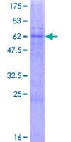 Human TRAM2 Protein (Recombinant GST)