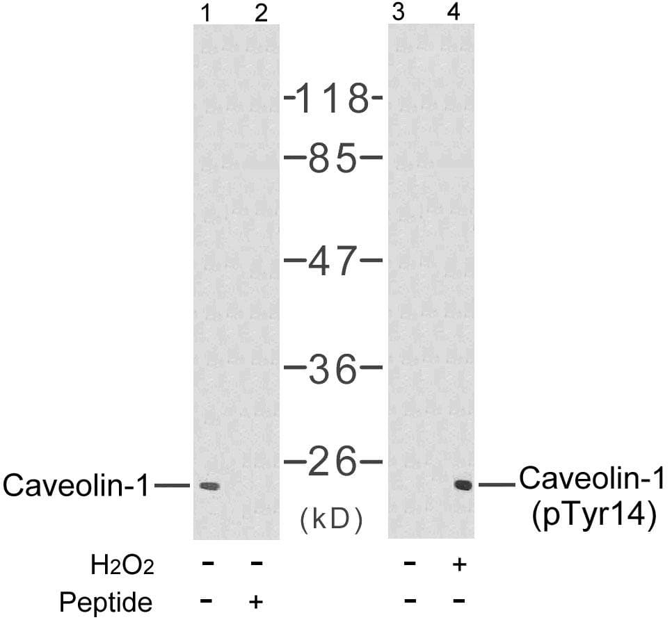 Polyclonal Rabbit anti-Human CAV1 / Caveolin 1 Antibody (p14, WB)