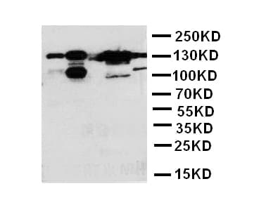 THBS2 / Thrombospondin 2 Antibody (aa637-655)