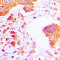 Polyclonal Rabbit anti-Human HK3 / Hexokinase 3 Antibody (C-Terminus, IHC, WB)