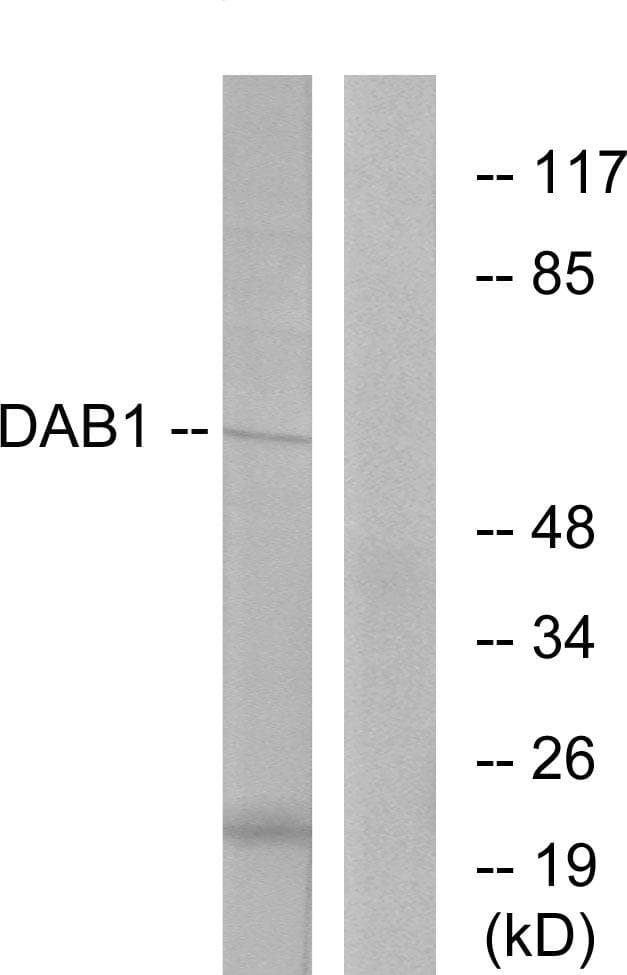 DAB1 Antibody (p220)