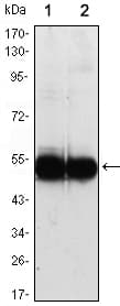 IHC-plus™ VCAM1 / CD106 Antibody (clone 6G9)