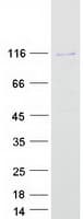 Human SIX5 Protein (Recombinant Myc-DDK (Flag))