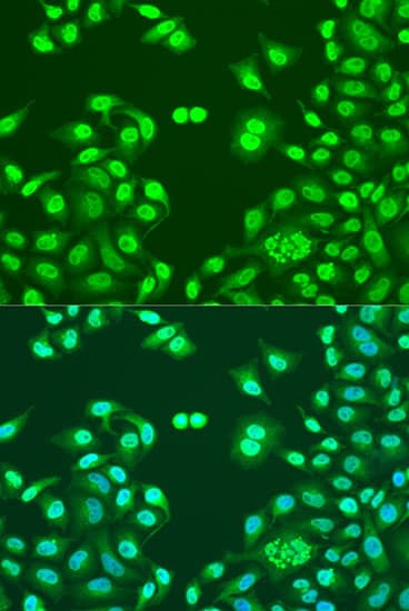 Polyclonal Rabbit anti-Human NUMA1 / NUMA Antibody (IHC, IF, WB)