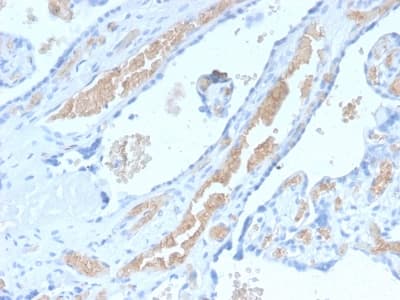 SPTA1 / Alpha Spectrin Antibody (aa356-475, clone SPTA1/2939R)