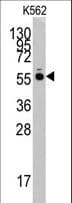 Polyclonal Rabbit anti-Human HARS Antibody (aa49-78, IHC, WB)