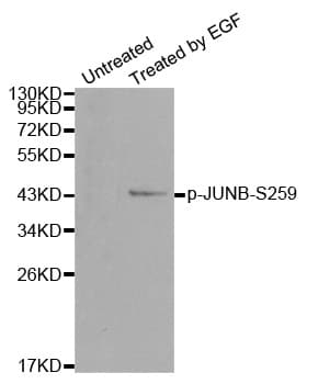 JUNB / JUN-B Antibody (phospho-Ser259)