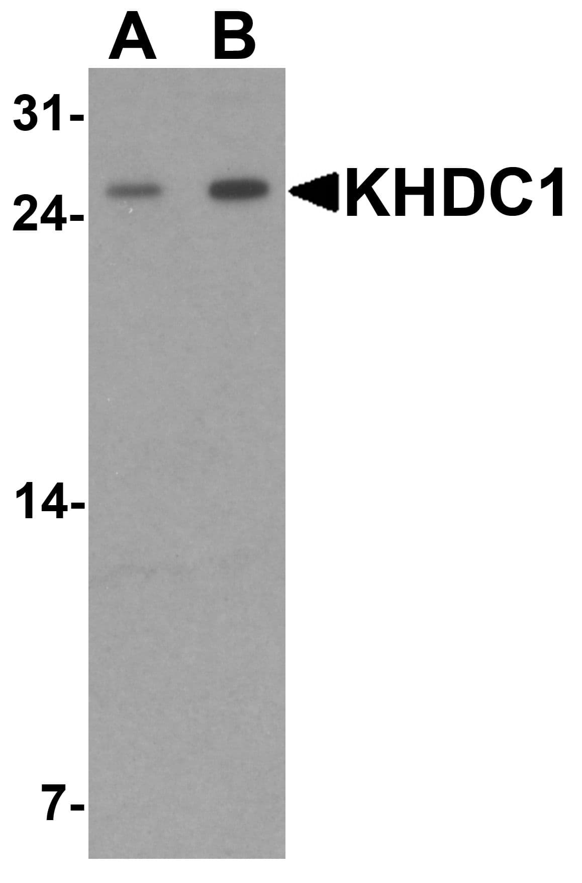 KHDC1 / C6orf148 Antibody