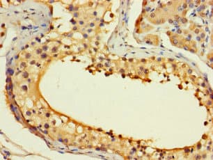 Polyclonal Rabbit anti-Human ASF1B Antibody