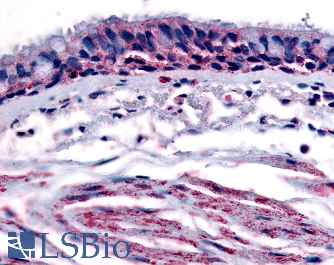 IHC-plus™ AHR Antibody (Internal)