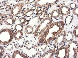 CYB5R3 / B5R Antibody (clone OTI2A10)