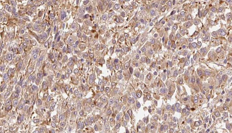 CST6 / Cystatin E/M Antibody