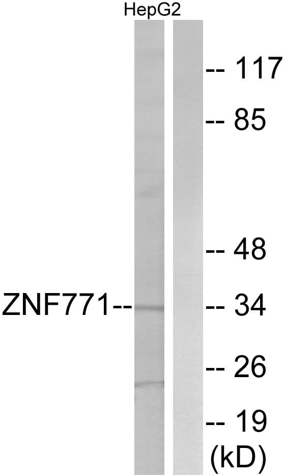 ZNF771 Antibody (aa161-210)