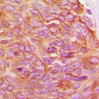 Polyclonal Rabbit anti-Human JUP/CTNNG/Junction Plakoglobin Antibody (C-Terminus, IHC, IF, WB)