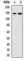Polyclonal Rabbit anti-Human WDR11 / BRWD2 Antibody (WB)