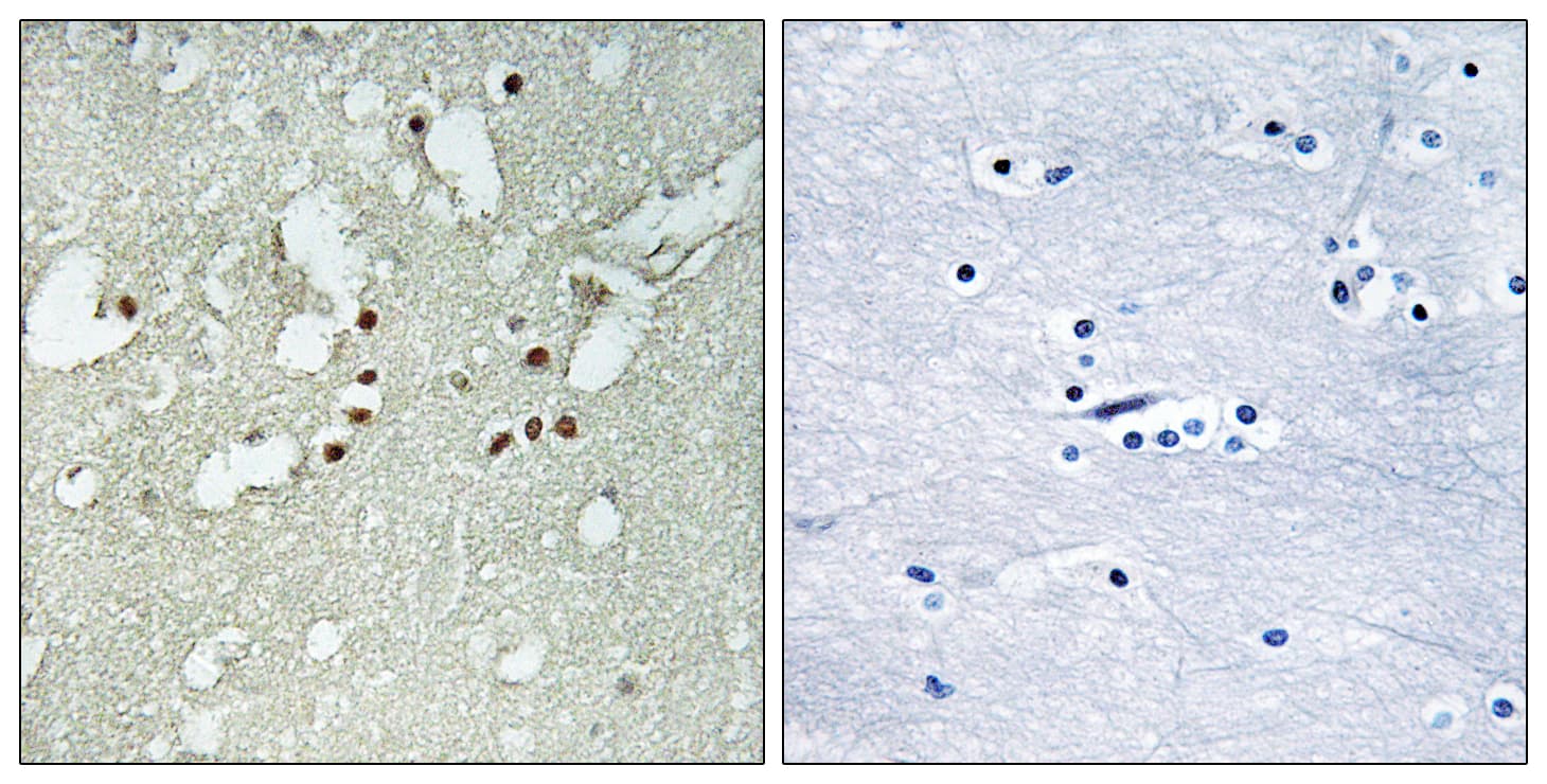 Polyclonal Rabbit anti-Human FOXJ3 Antibody (aa191-240, IHC)